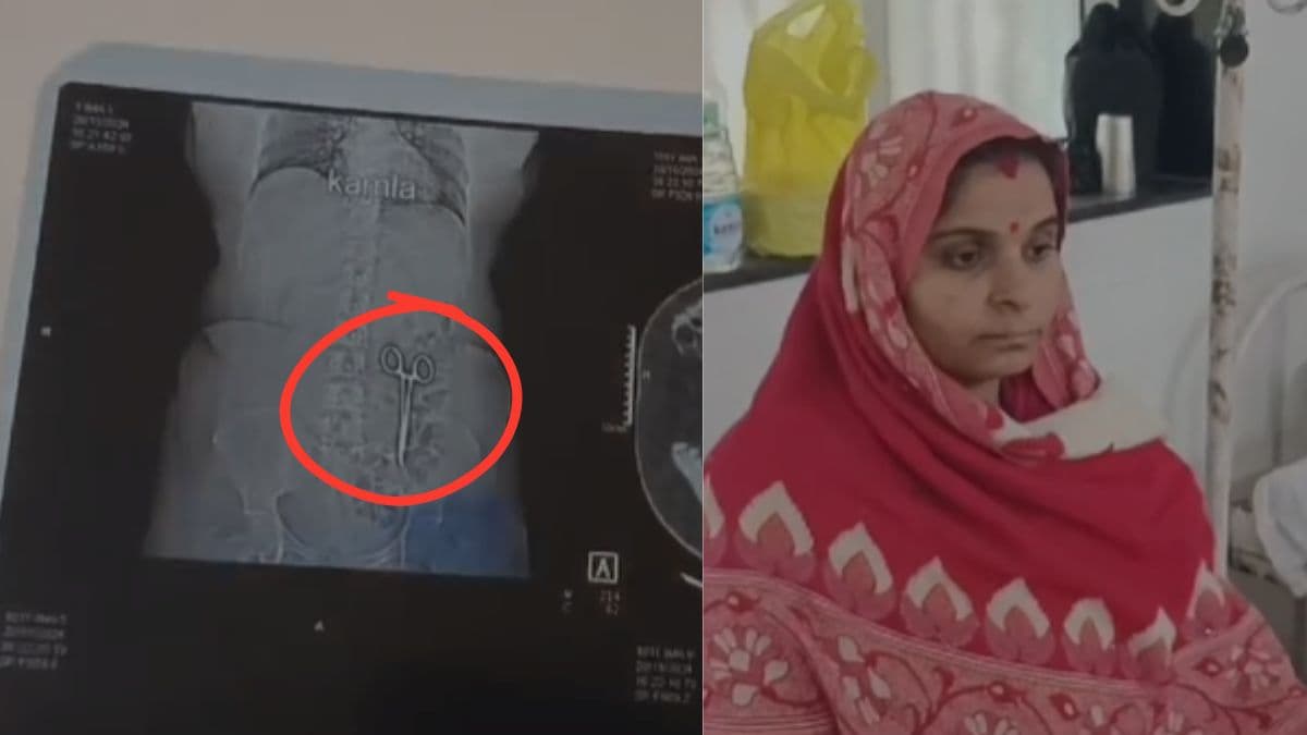 पेट दर्द पर जब कराया सीटी स्कैन तो महिला के उड़े होश, दो साल पहले की डॉक्टरों की चूक का खुलासा
