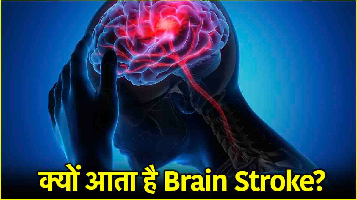 Brain Stroke Causes: सर्दियों में ये 5 संकेत ब्रेन स्ट्रोक के लक्ष्ण, क्या कहते हैं डाक्टर?