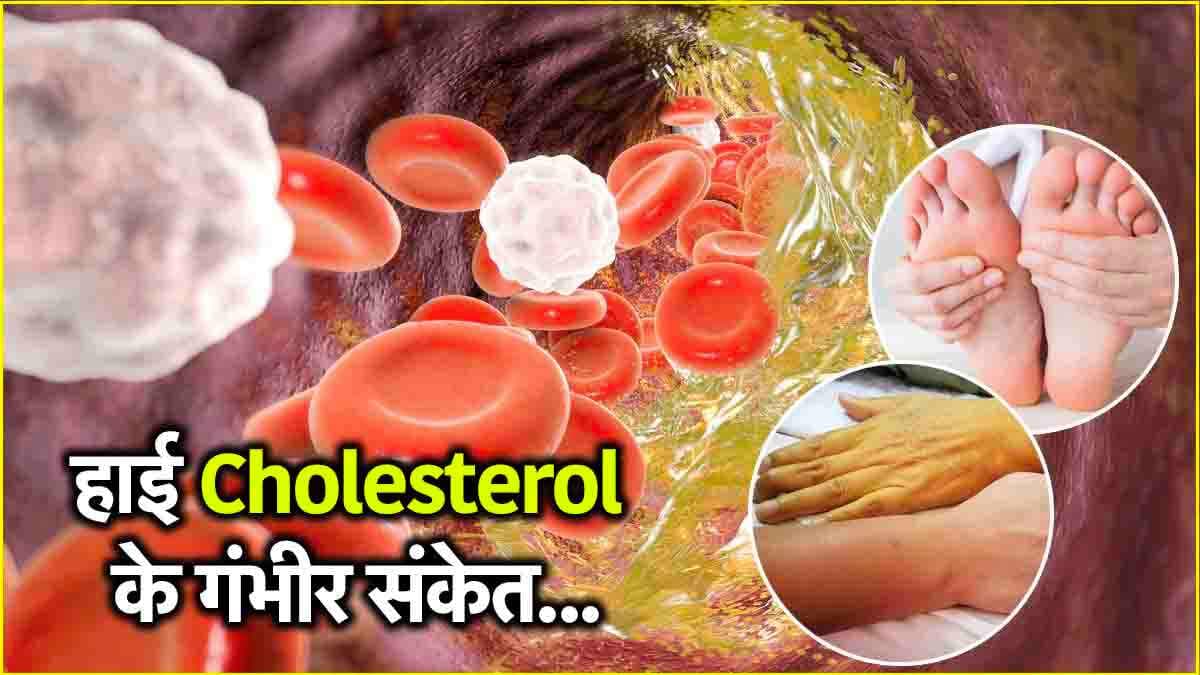 कोलेस्ट्रॉल बढ़ने पर बॉडी देती है ये 5 संकेत, सर्दियों में दोगुना हो जाता है खतरा!