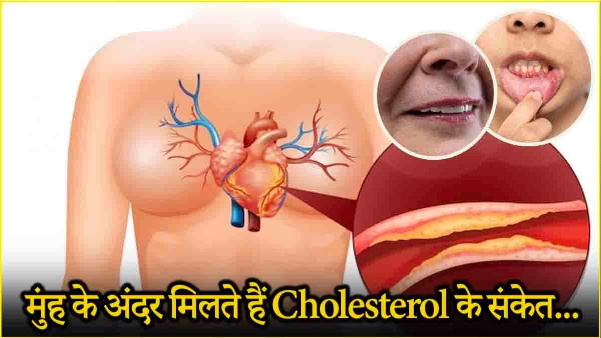 कोलेस्ट्रॉल बढ़ने पर चेहरे पर दिखते हैं ये 5 संकेत, अनदेखा करना पड़ सकता है भारी!