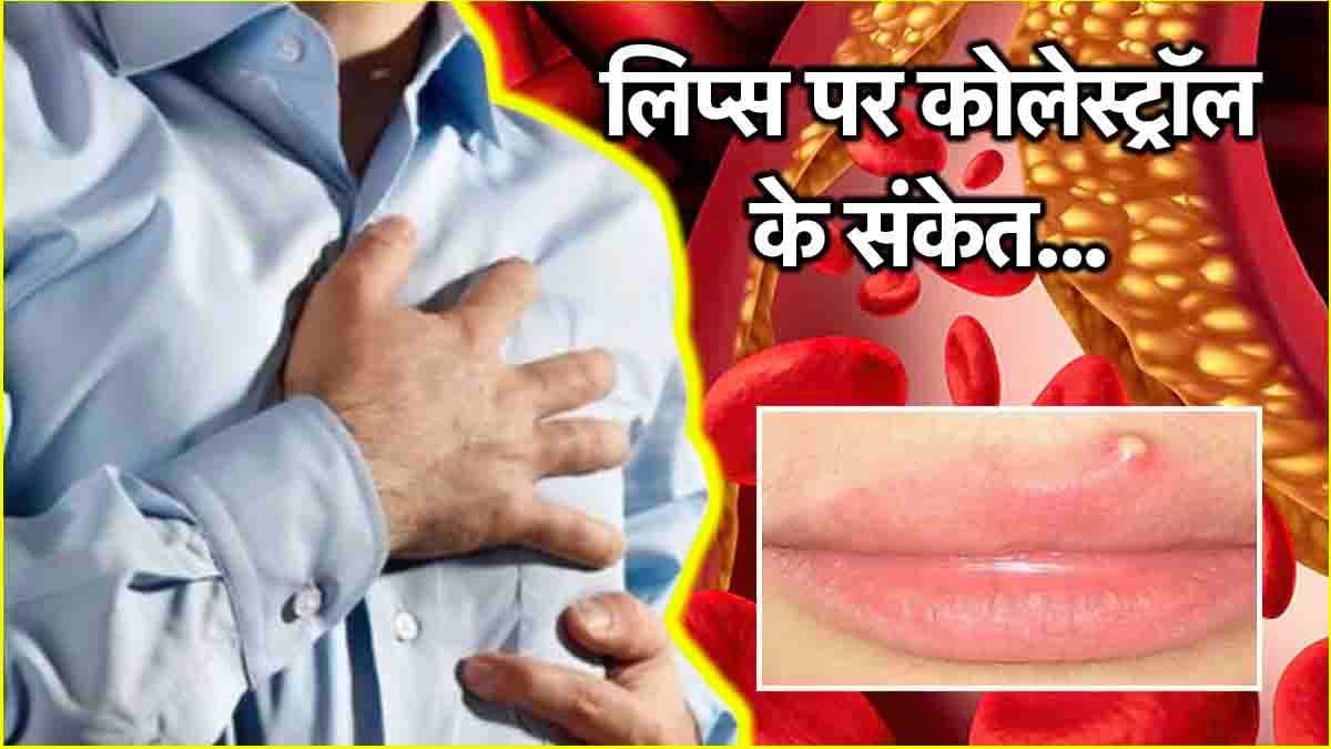खून में मिलते हैं कोलेस्ट्रॉल बढ़ने के 10 संकेत! अपना लीजिए डाइटीशियन की सलाह