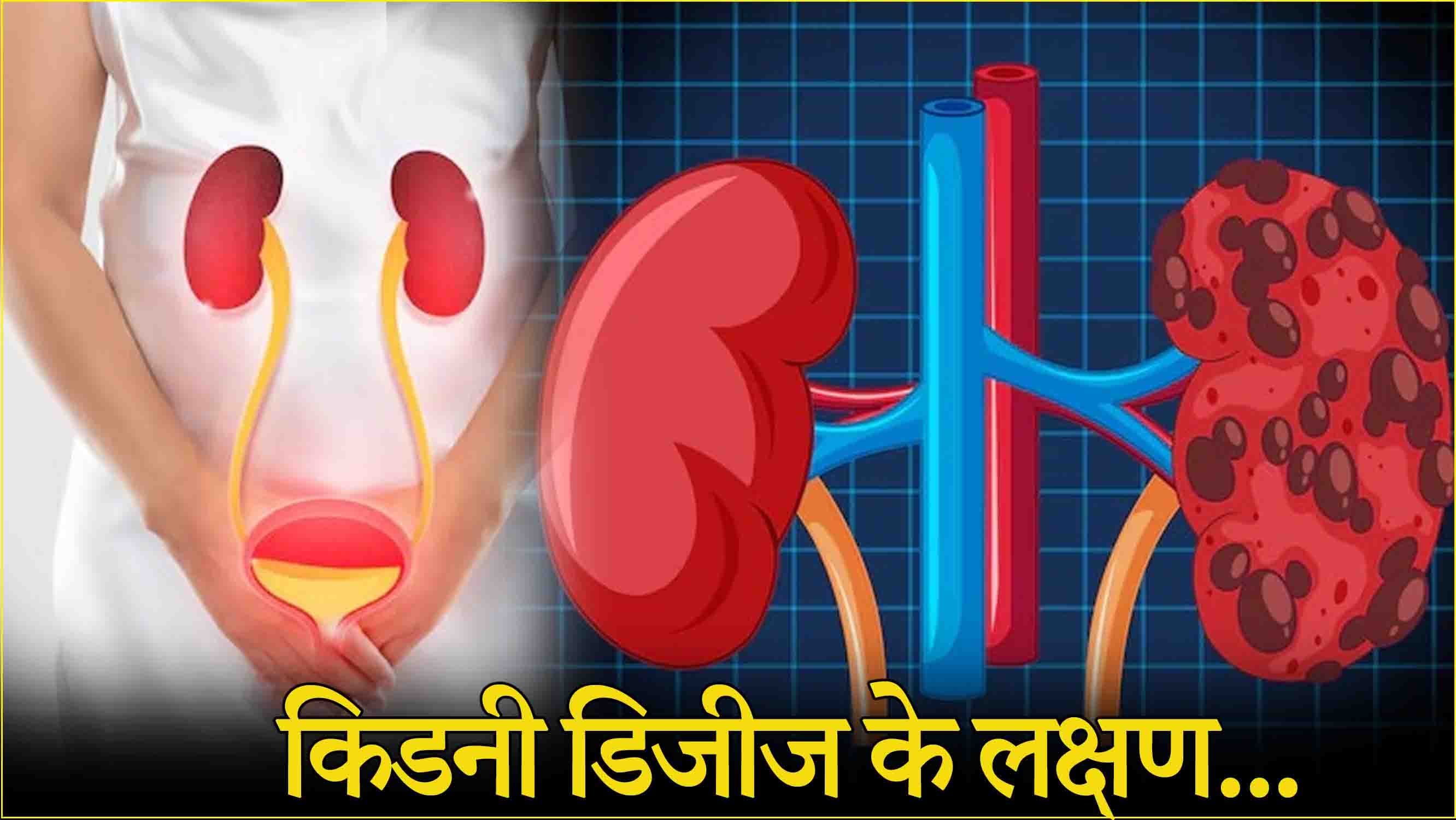 Kidney Damage: यूरिन इन्फेक्शन से डैमेज हो सकती है किडनी, इन 5 संकेतों को न करें इग्नोर
