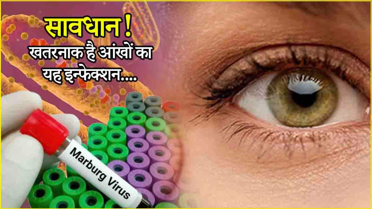कोरोना से भी खतरनाक है आंखों की यह बीमारी, जानें शुरुआती संकेत और बचाव