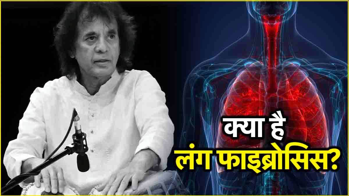 Zakir Husain Death: फेफड़ों की यह बीमारी कितनी गंभीर, जानें शुरुआती संकेत और बचाव