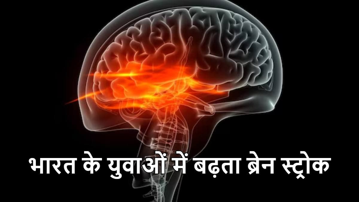 brain stroke causes