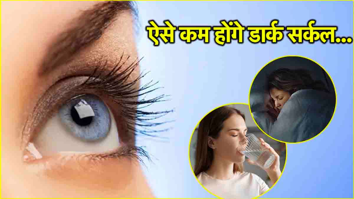 Eye Care Tips: आंखों के नीचे काले धब्बे होंगे छूमंतर, फॉलो करें बस ये 7 टिप्स