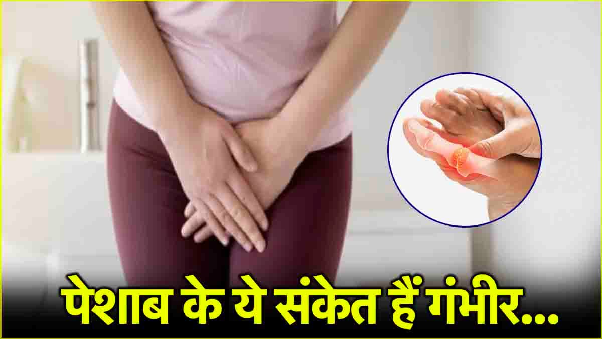 इन बीमारियों को दावत देता है Uric Acid बढ़ना; डॉक्टर से जानिए कंट्रोल करने के उपाय
