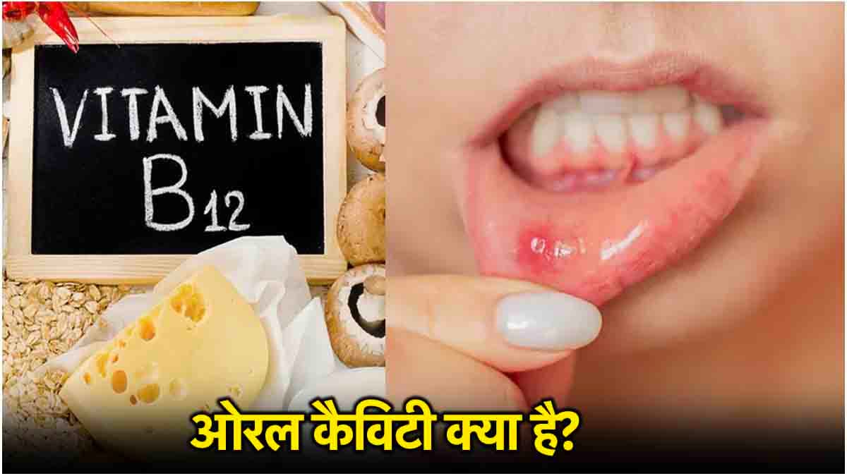 Oral Cavity भी विटामिन बी-12 के कम होने का संकेत, ये 3 लक्षण बड़े गंभीर