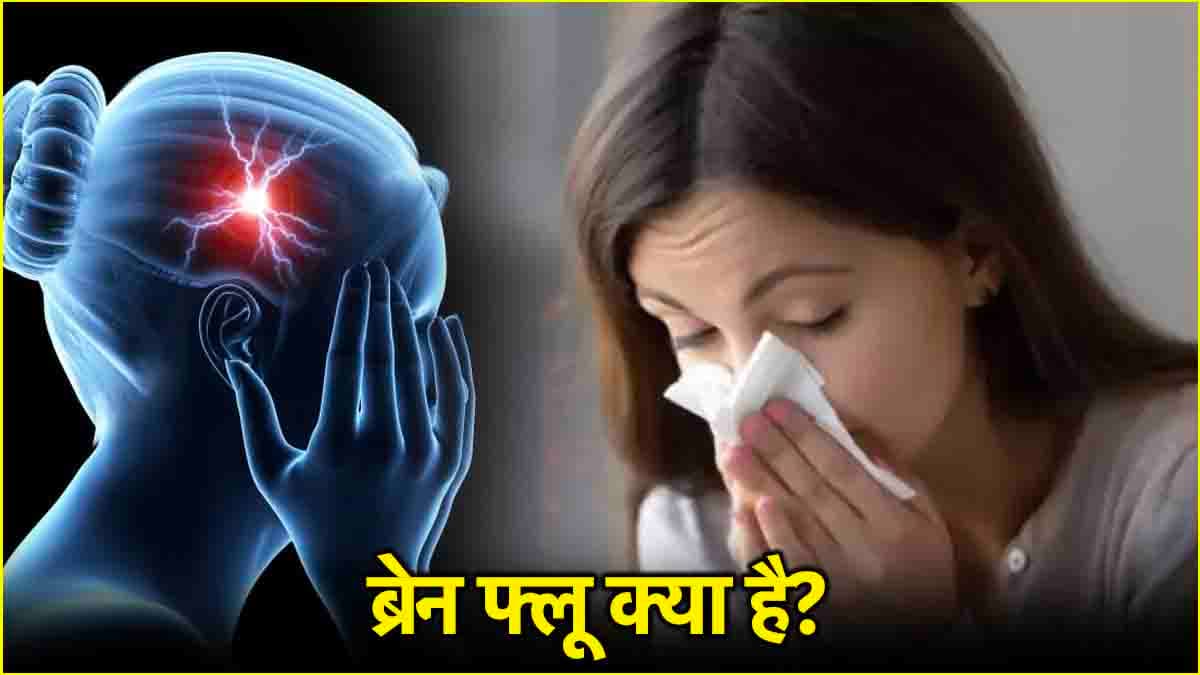 Flu Brain क्या है? जानें दिमाग के लिए कितना खतरनाक और इससे जुड़ी बीमारियां