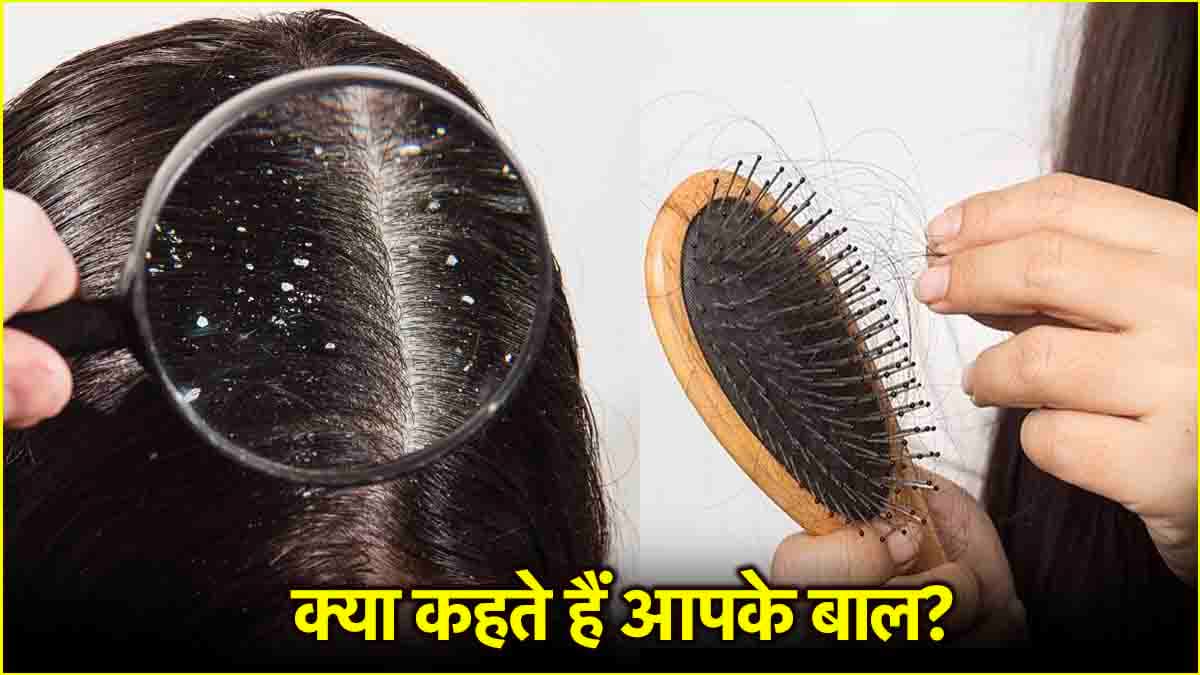Hair Health Signs: बालों से पता लगाए आप हेल्दी है या नहीं, एक्सपर्ट से जानें संकेतों का सही मतलब