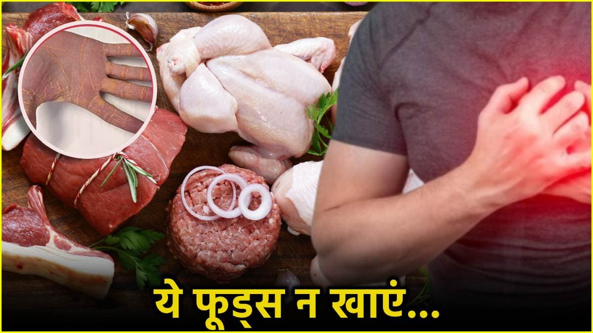 Cholesterol के बढ़ने से हथेली में दिखता है ऐसा संकेत, जांच पर पता लगी बीमारी
