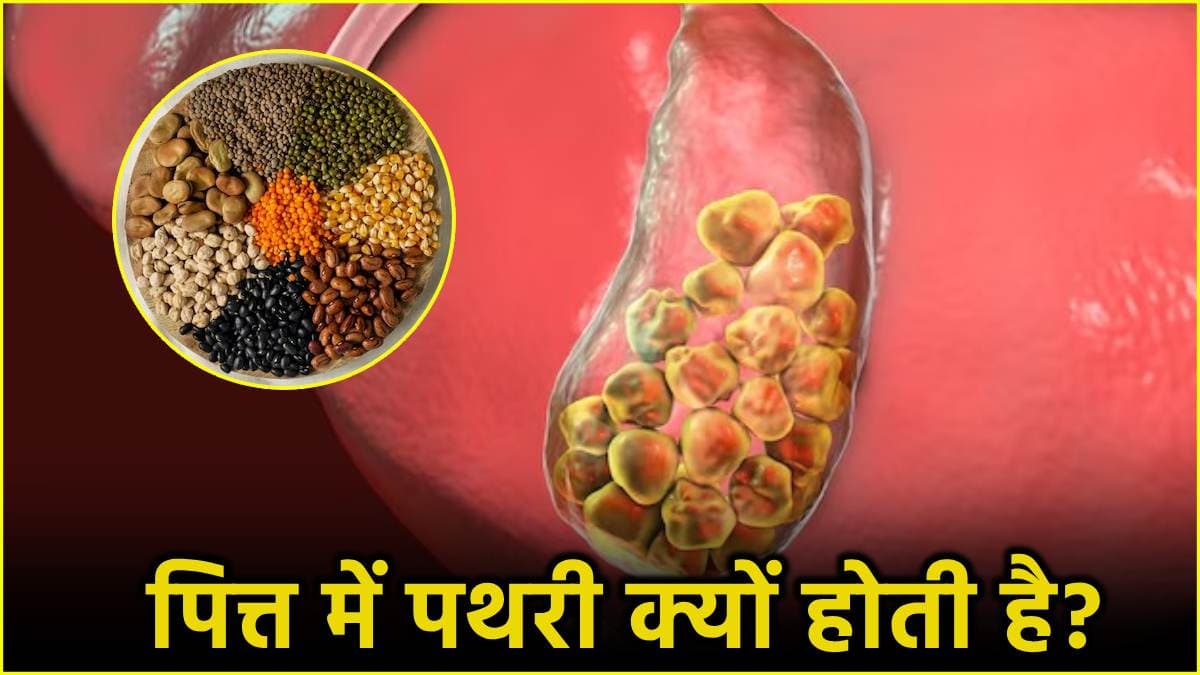 Gall Bladder Stone होने के संकेत देते हैं ये 3 बदलाव, बॉडी में चेंज ऐसे करें महसूस