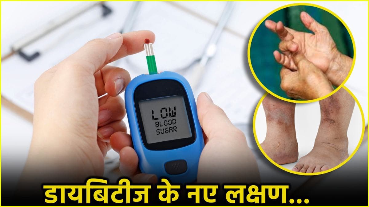 Diabetes Symptoms: शुगर बढ़ने पर हाथों-पैरों में नजर आते हैं ये 5 संकेत, डॉक्टर से जानें उपाय