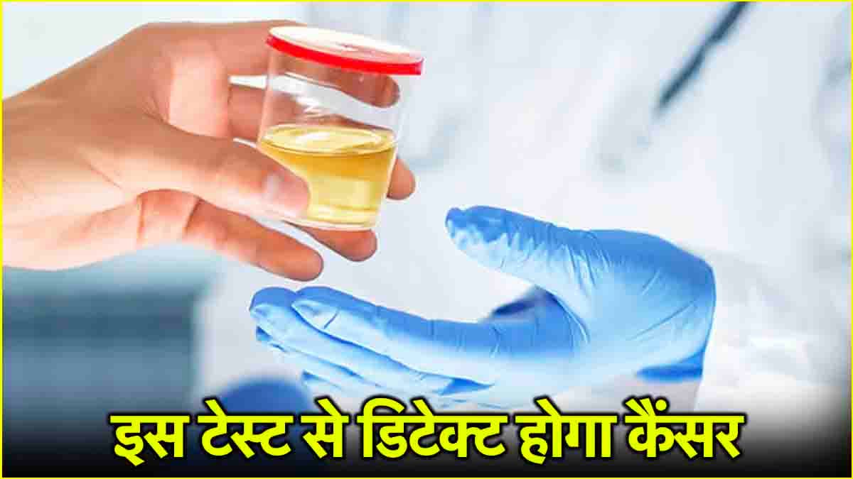 New Urine Test: पेशाब से पता चलेगा कैंसर है या नहीं, पुरुष रहें ज्यादा सतर्क, जानें कैसे