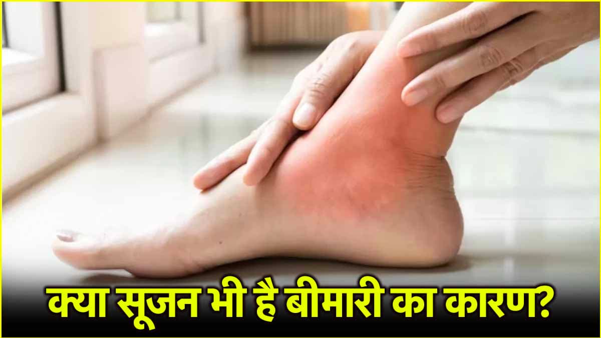 Health Tips: शरीर में बिना कारण के सूजन हो सकती है इस बीमारी का संकेत! जानें एक्सपर्ट की राय