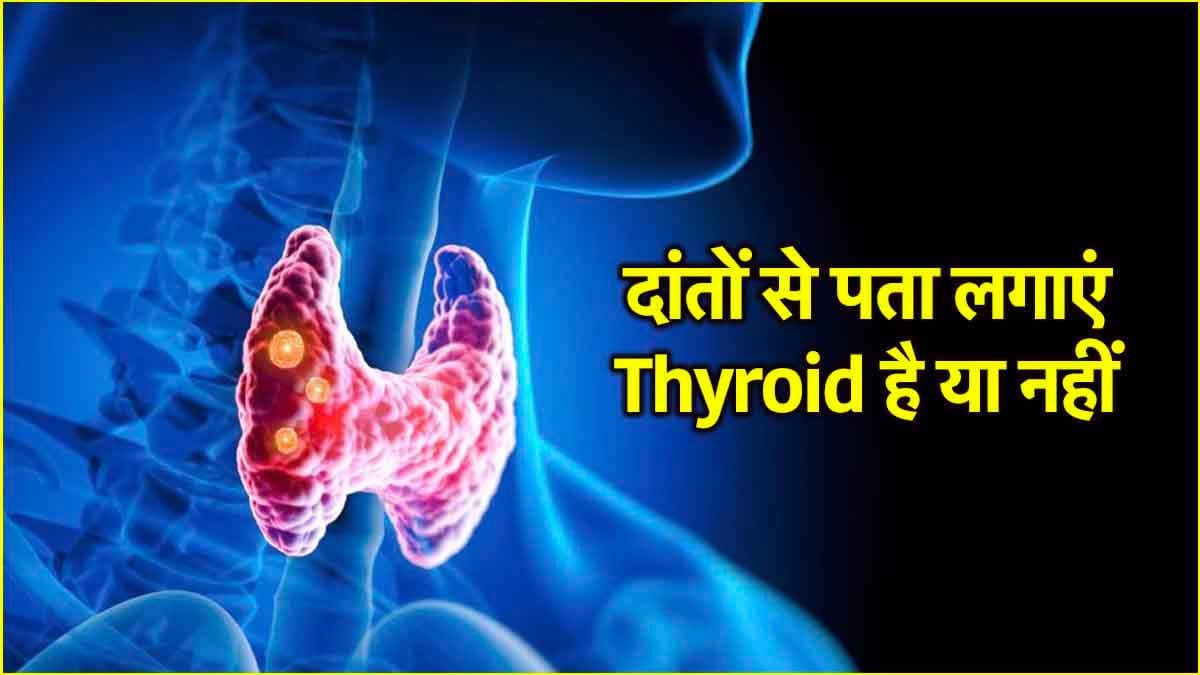 Thyroid Causes: दांतों की ये समस्याएं भी हैं थायराइड का एक संकेत, जानें डॉक्टर की एडवाइस