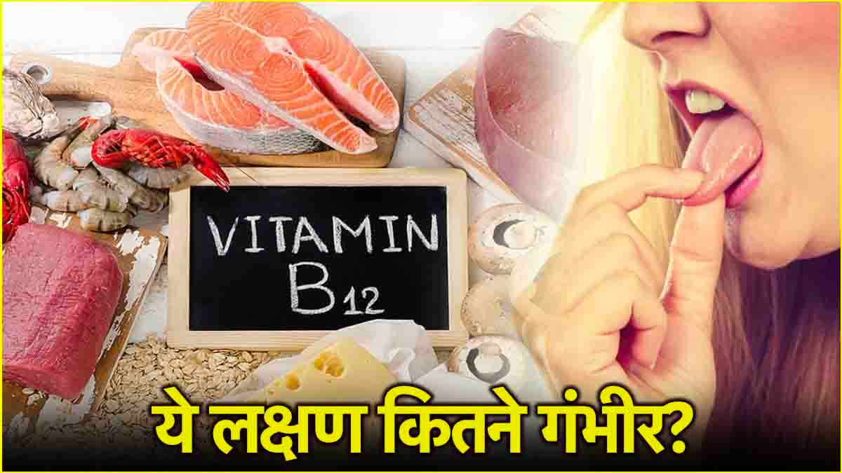 Vitamin B-12 की कमी का मुंह में दिखने वाला दर्दनाक लक्षण, इन फूड्स से दूर होगी कमी