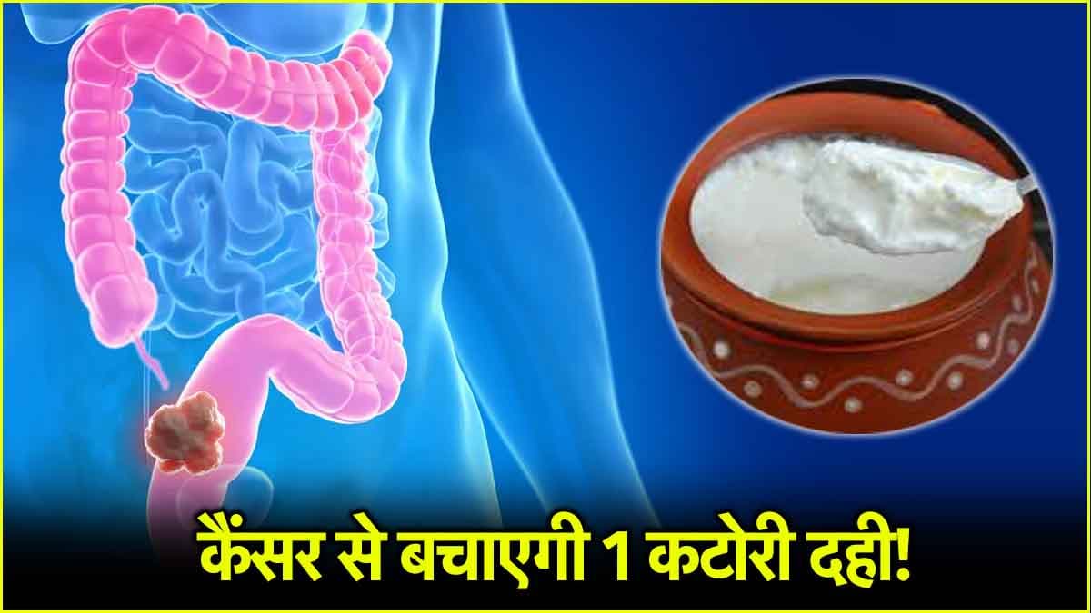 Colon Cancer Prevention Tips: रोज खाएं 1 कटोरी दही, नहीं होगा कैंसर, नई स्टडी में हुआ खुलासा