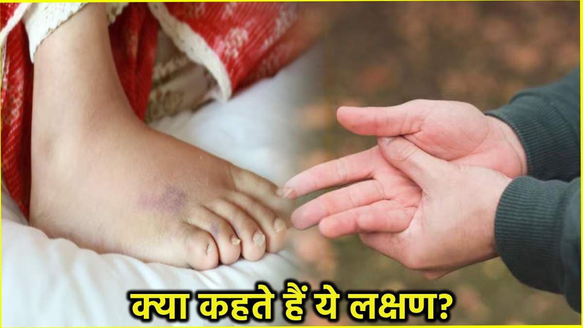 Health Tips: हाथ-पैर में झनझनाहट होना किस गंभीर बीमारी का संकेत? डाइटीशियन से जानें बचाव के उपाय
