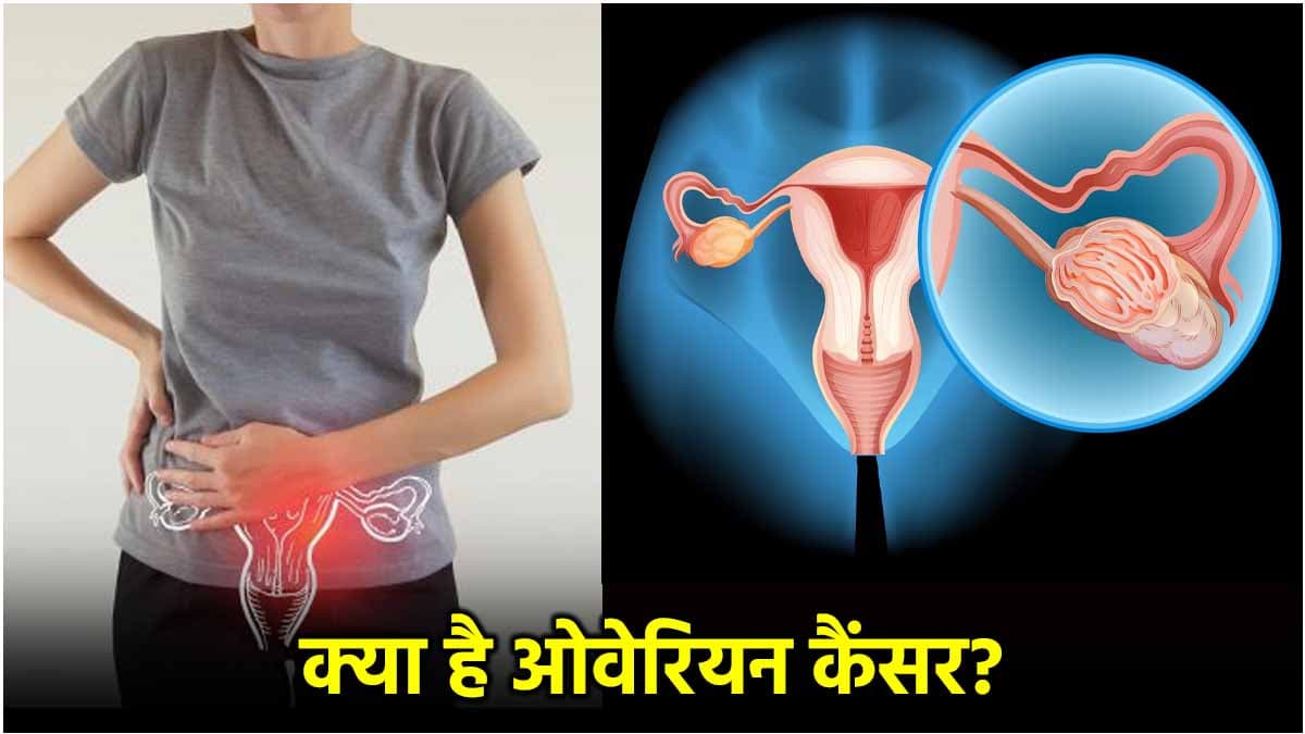 Cancer Symptoms: महिलाओं में दिखते हैं कैंसर के 7 संकेत; जानें लक्षण, बचाव और इलाज