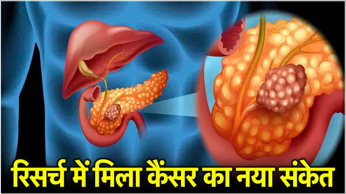 Cancer New Sign: कैंसर का नया साइलेंट संकेत, ताइवान की रिसर्च में हुआ बड़ा खुलासा