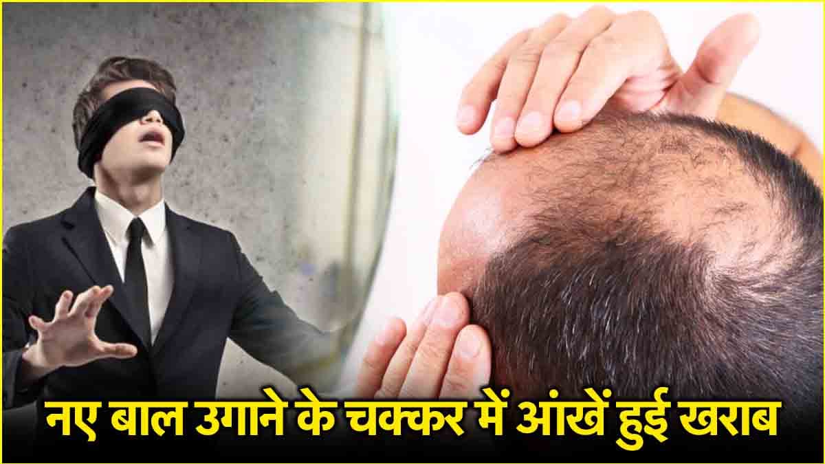 सावधान! बाल उगाने के चक्कर में आंखें न गंवा बैठें आप, ‘चमत्कारी कैंप’ ने दिया ऐसा दर्द, अस्पताल पहुंचने लगे लोग