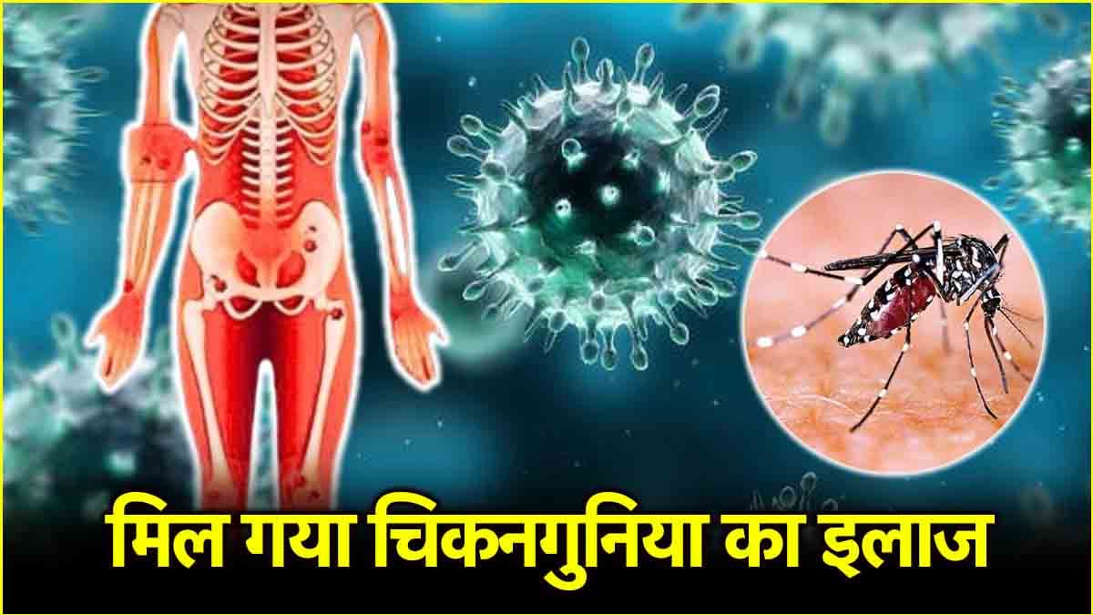 चिकनगुनिया से लेकर मच्छरों की हर बीमारी का इस दवा से हो सकता है इलाज, नई स्टडी में खुलासा