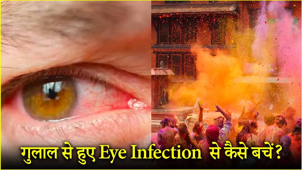 Holi 2025: होली के रंगों से आंखों में जलन को ऐसे दूर भगाएं, 5 टिप्स अपनाएं