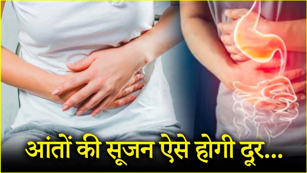 Inflammatory Bowel Disease: क्यों होती है आंतों में सूजन? डॉक्टर ने बताए लक्षण, घरेलू उपाय भी जानें