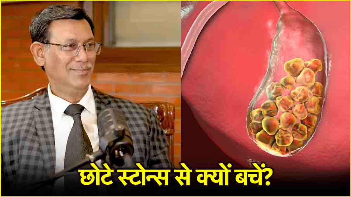Stones Causes: ज्यादा खतरनाक है छोटी पथरी, एक्सपर्ट ने बताया क्यों?