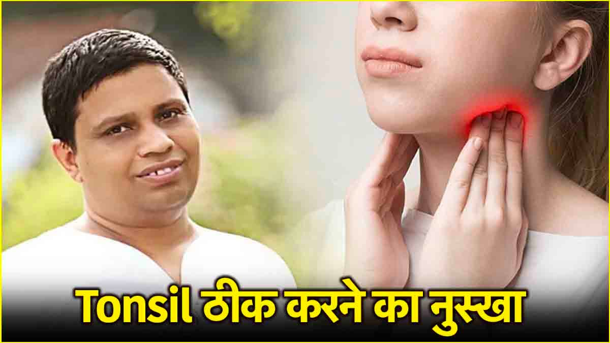 Acharya Balkrishna Health Tips: टॉन्सिल ठीक करने का जबरदस्त उपाय, पहली बार ट्राई करने से मिलेगी राहत