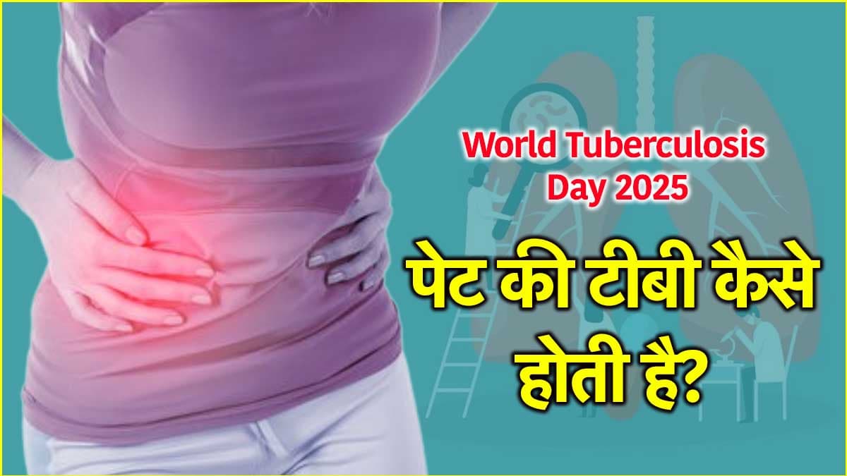 World TB Day: पेट दर्द भी कही टीबी के लक्ष्ण तो नहीं? जानें  बचाव के तरीके