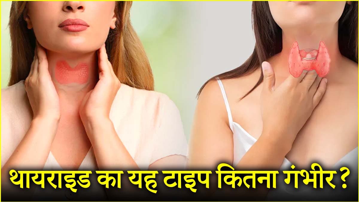 थायराइड के इन 5 संकेतों को इग्नोर न करें महिलाएं, घरेलू नुस्खे भी कारगर