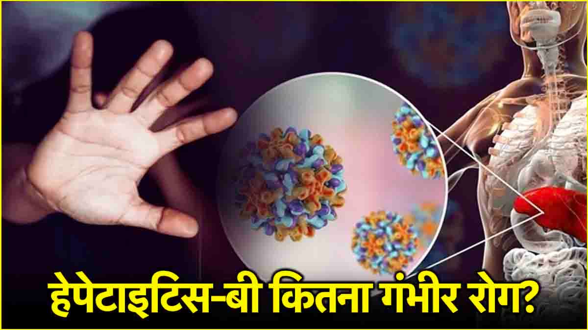 हेपेटाइटिस-बी बीमारी कितनी खतरनाक? वाराणसी केस की पीड़िता जिसकी शिकार