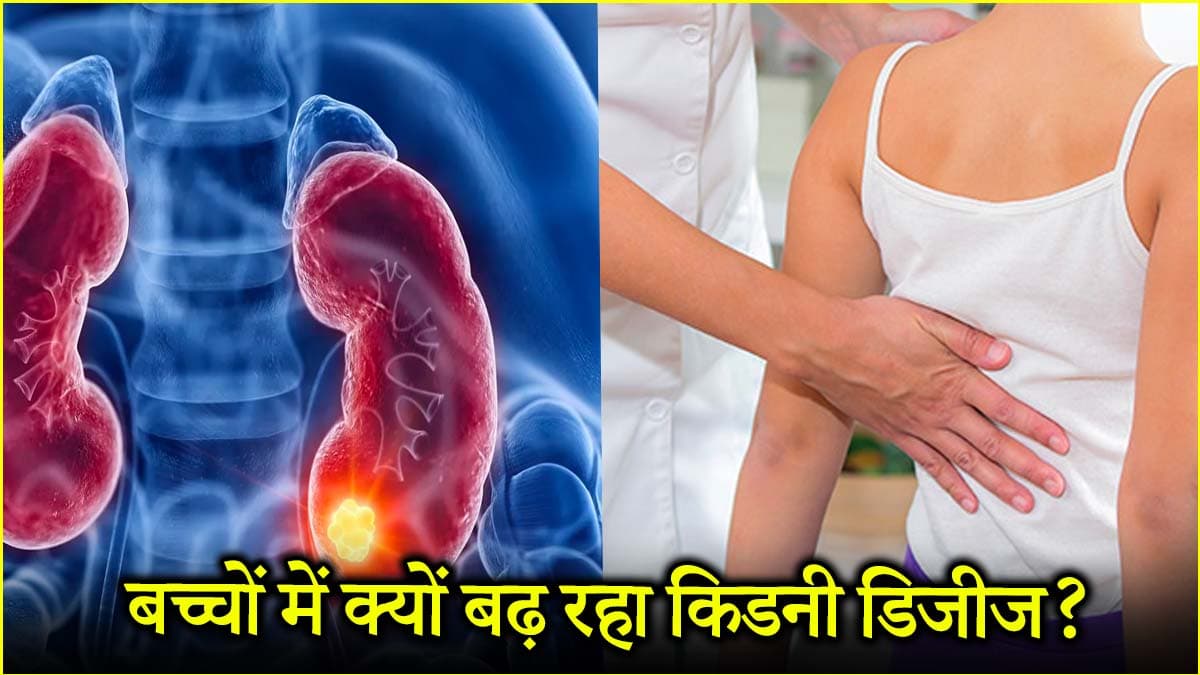 शरीर का फिल्टर है किडनी... इसको सही रखना क्यों जरूरी? जानें डॉक्टर से