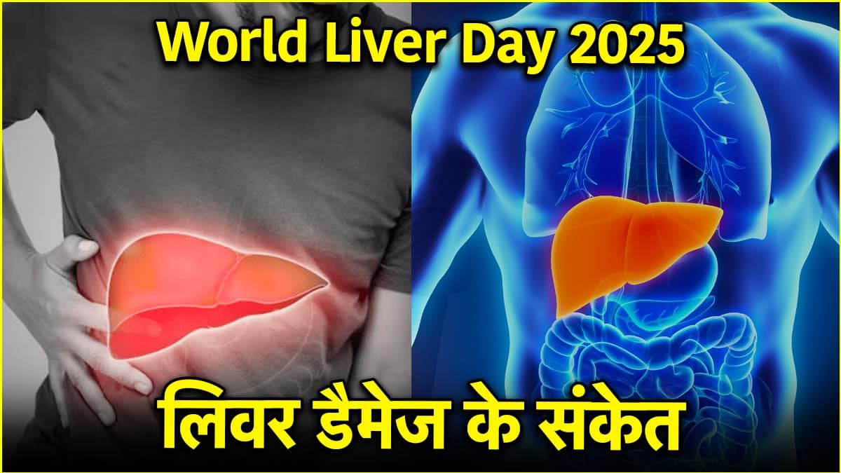 World Liver Day 2025: लिवर को खराब कर रही हैं ये आदतें, गर्मियों में ऐसे रखें ख्याल