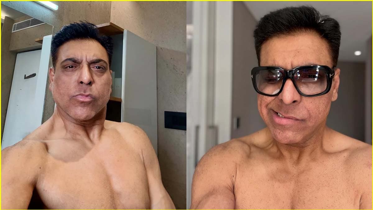 Ram Kapoor की सेमी न्यूड तस्वीरें देख चौंके फैंस, टेढ़े मुंह और पिचके चेहरे ने बढ़ाई चिंता