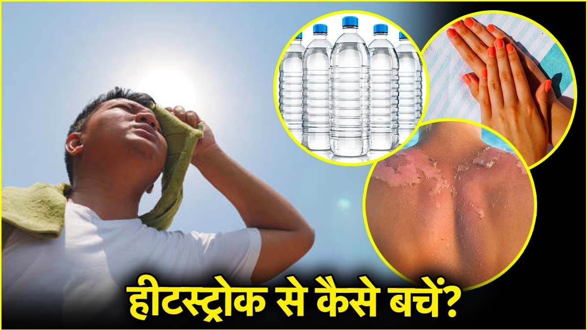 गर्मियों में बढ़ जाती हैं इन्फेक्शन-डिहाइड्रेशन जैसी समस्याएं! जानें बचाव के उपाय