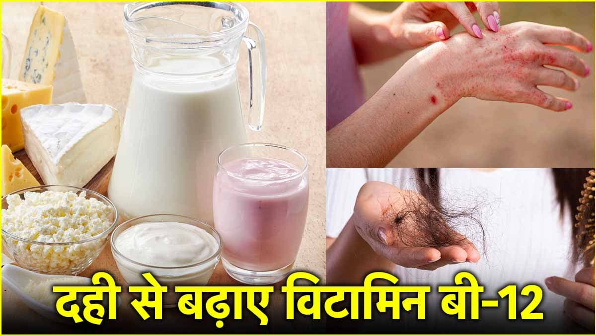 शरीर में विटामिन बी-12 की कमी ऐसे होगी दूर, दही के साथ खाएं ये चीजें