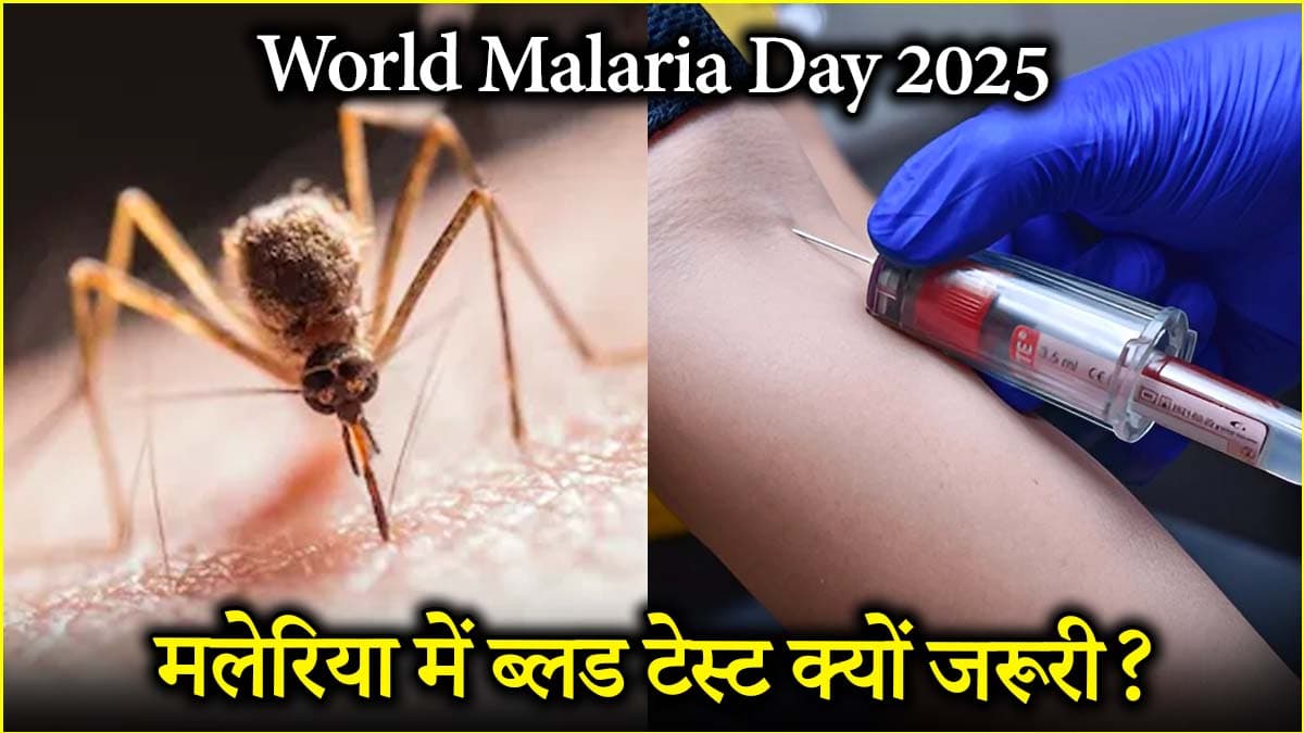 World Malaria Day 2025: मलेरिया में कौन-से ब्लड टेस्ट जरूरी? टेस्टिंग से जुड़ी अहम जानकारी
