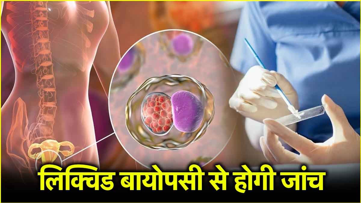 सिर्फ ब्लड टेस्ट से पता चलेगा सर्वाइकल कैंसर है या नहीं? रिसर्च में हुआ खुलासा