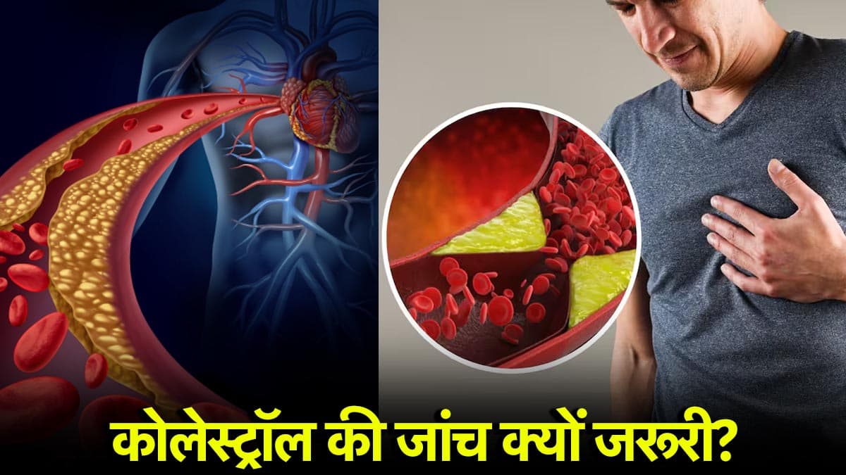 Cholesterol Causes: कोलेस्ट्रॉल क्यों बन गया है दिल का दुश्मन? जानें ऐसा क्यों बोले डॉक्टर