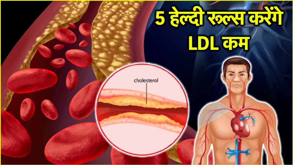 Cholesterol Causes: खाने में ये 5 बदलाव करेंगे कोलेस्ट्रॉल को मैनेज, हार्ट हेल्थ भी होगी इंप्रूव