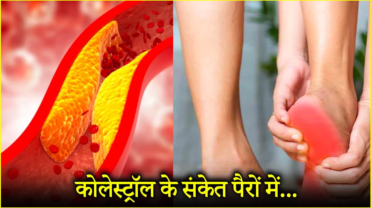Cholesterol Symptoms: पैरों में दिखाई देते हैं कोलेस्ट्रॉल के 3 संकेत, क्या कहती है रिसर्च