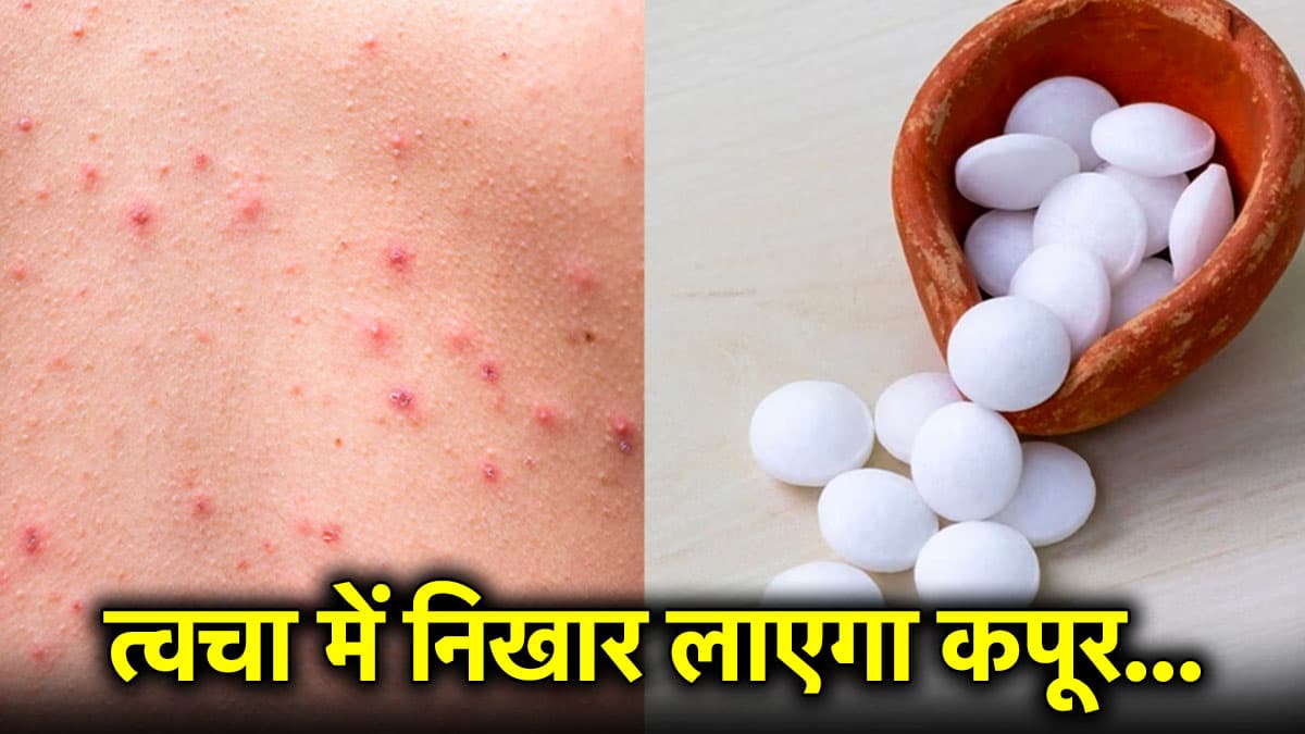 स्किन में निखार लाएगा कपूर, जानिए इसके 5 जबरदस्त ब्यूटी बेनिफिट्स