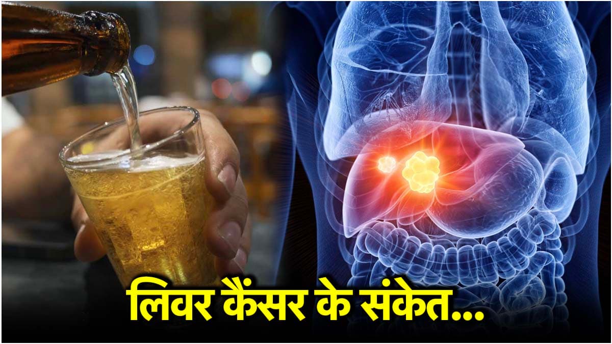 Cancer Cause: फैटी लिवर से लिवर कैंसर होने का रिस्क कितना? डॉक्टर से जानें संकेत