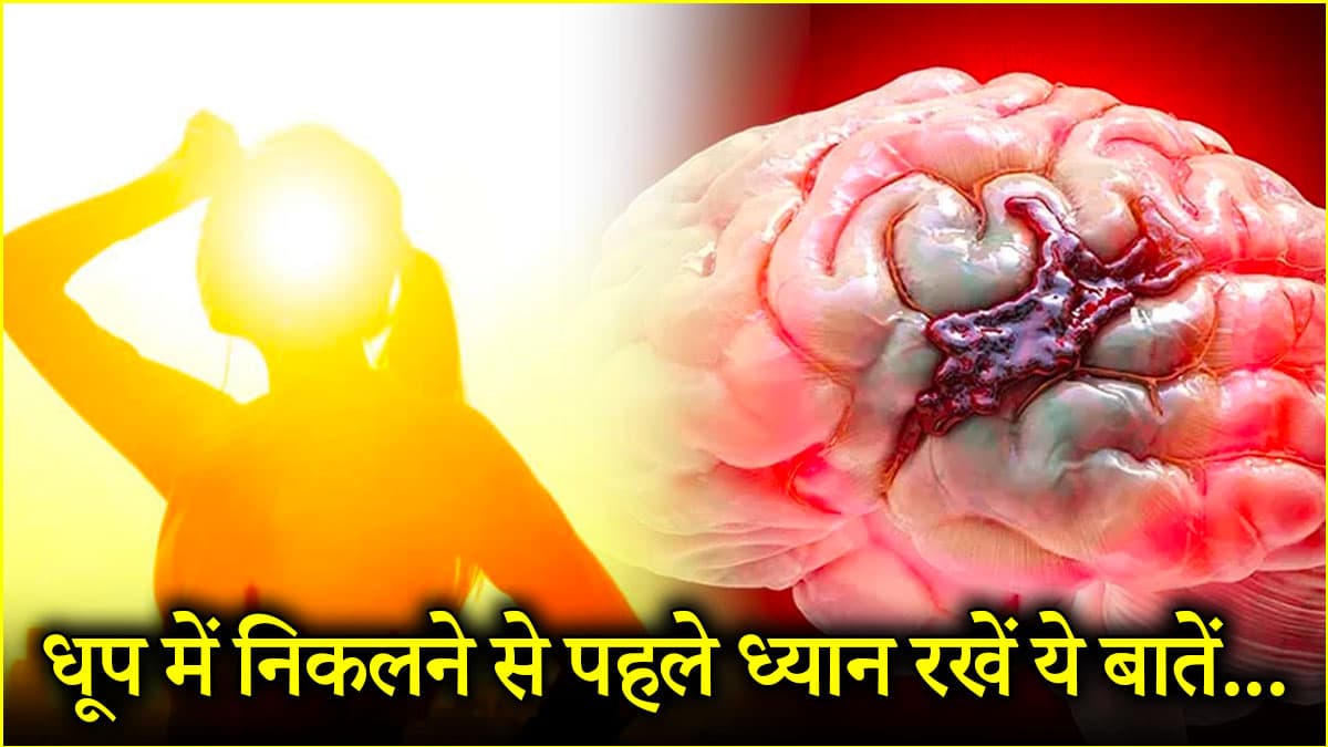 AC से सीधे धूप में जाने वाले लोग रहें सावधान, ब्रेन हैमरेज का बढ़ रहा रिस्क