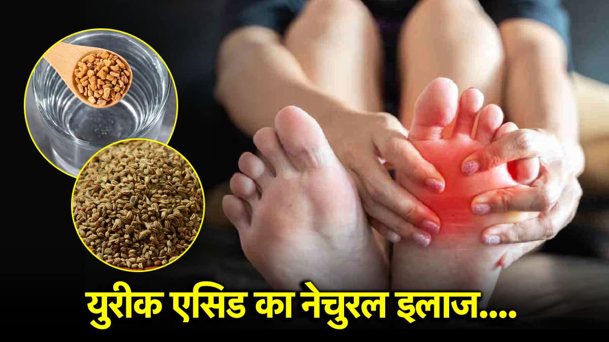 URIC ACID बढ़ जाए तो कितना हो सकता है खतरनाक? इन नेचुरल तरीकों से करें कंट्रोल