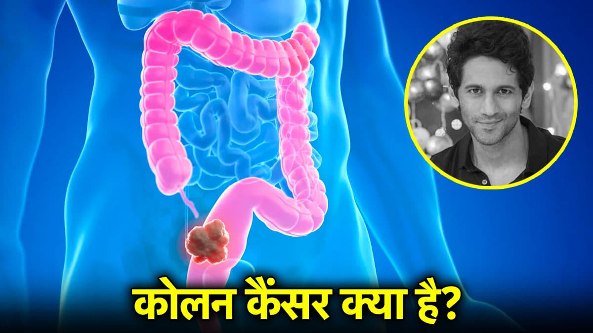 Cancer Cause: पेट दर्द और गैस से भी हो सकता है कैंसर! किस आयु के लोगों को ज्यादा खतरा?