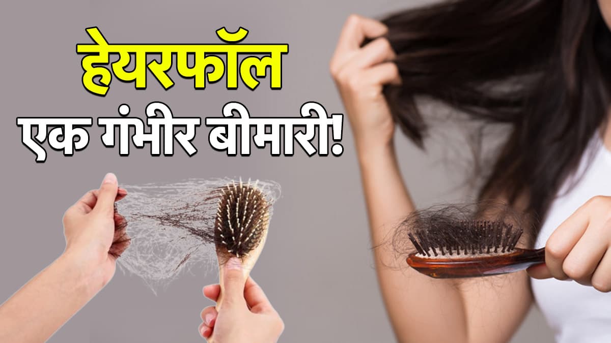 तनाव  ही नहीं इस बीमारी में भी गिरते हैं बाल, डॉक्टर से जानिए कारण और इलाज